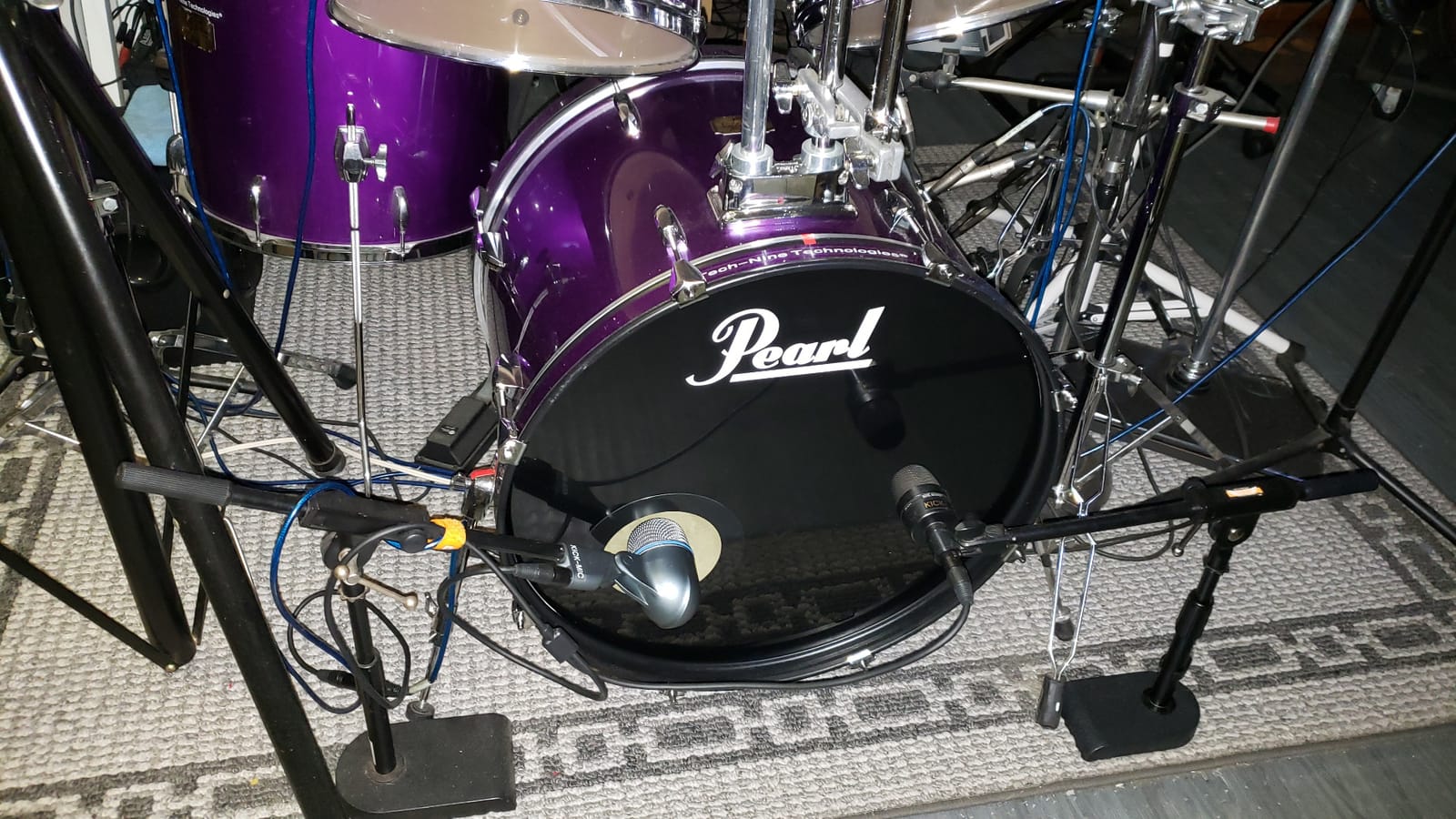 Shure BETA 52A Kick Drum Microphone - Supercardioid Dynamic Mic with High Output Neodymium Element, Locking Stand Adapter, Durabl Steel Mesh Grille and Shock Mount customer photo 1